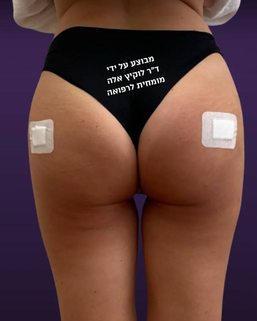 אחרי הטיפול, הישבן, מבט מאחור